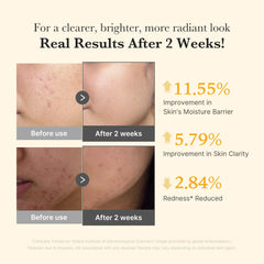 [Subscr.] Kojic Acid Turmeric Capsule Serum